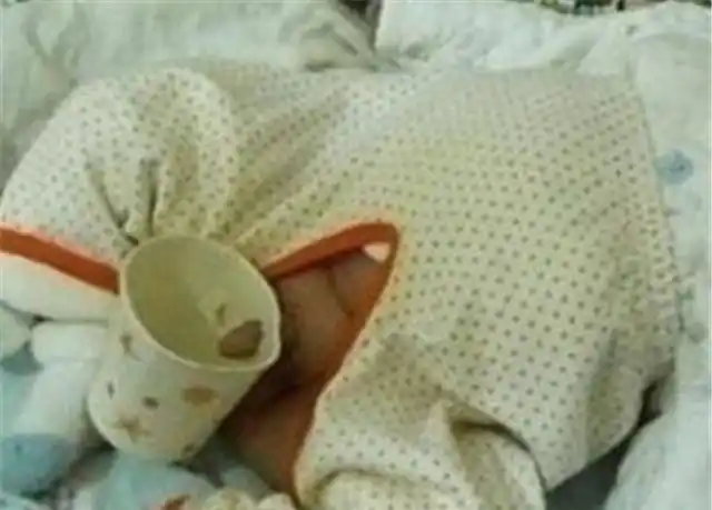 聪明的刘女士想出了一个两全其美的办法,用一个小瓶子给宝宝接在鸡鸡