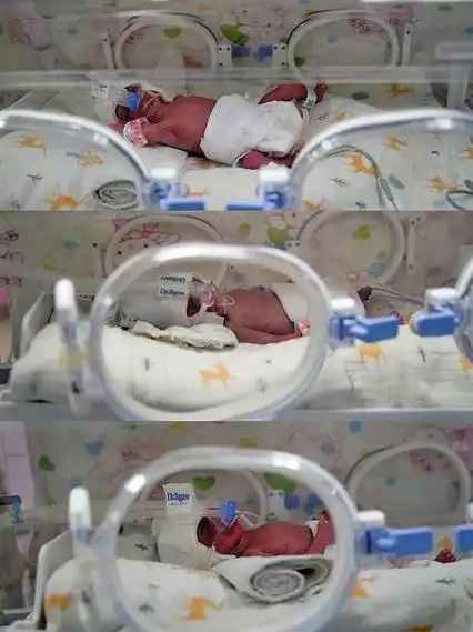 安徽罕见双绒三羊三胞胎顺利降生