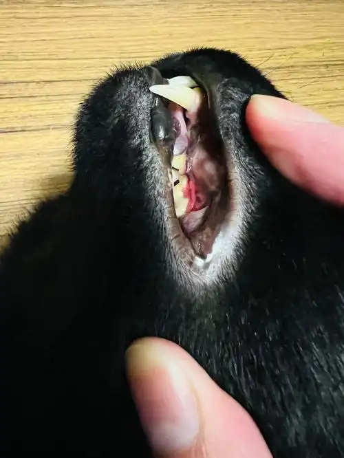 请问这是不是牙龈发炎