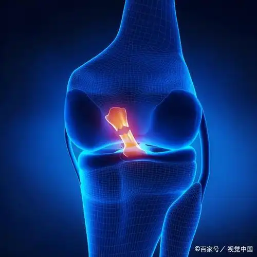 膝盖受过伤还能健身运动吗?康复师说,关键是留意好这三点