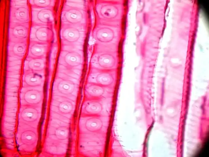 99木材组织实习(6b)–真实版之木材细胞壁纹孔