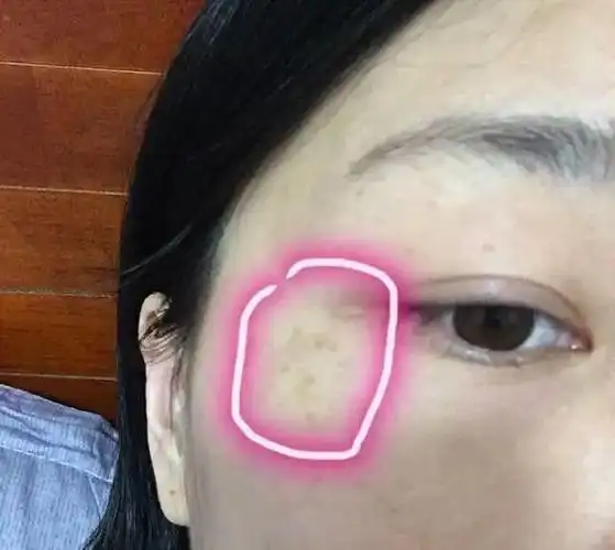 妇科病都"写"在脸上?脸上若没这7个"异常",恭喜你,很健康!