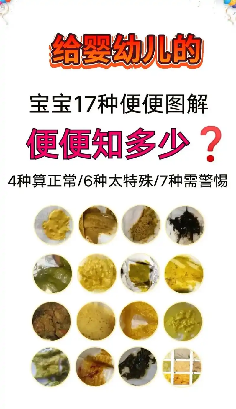 育儿经验分享 #宝宝粑粑分辨 #育婴知识 #婴儿辅食过敏的 - 抖音