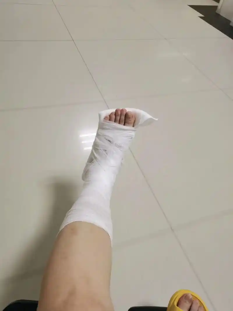 祸不单行,不小心从楼梯摔下来了—把脚骨折了,成年人的世界没有 - 抖