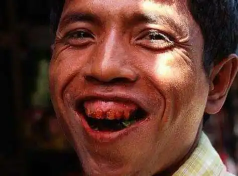 吃槟榔的下场的图片 嚼槟榔前后脸部的图片