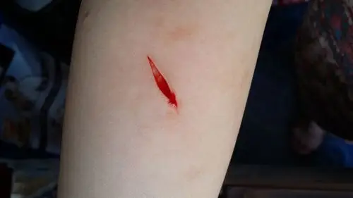 玻璃划破胳膊用不用打破伤风,用不用缝针.用不用打破伤风?