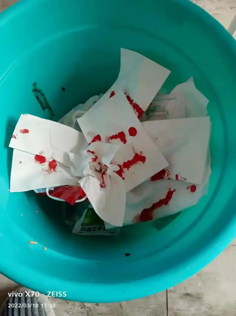 现在家看电视忽然鼻子出血,喷是出来了,不知道是啥意思,有没去 - 抖音