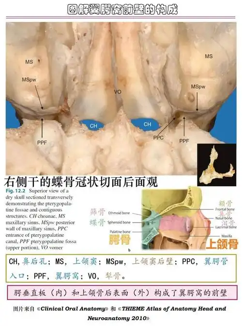 你弄不清楚的翼腭窝,我们帮你搞定!_解剖