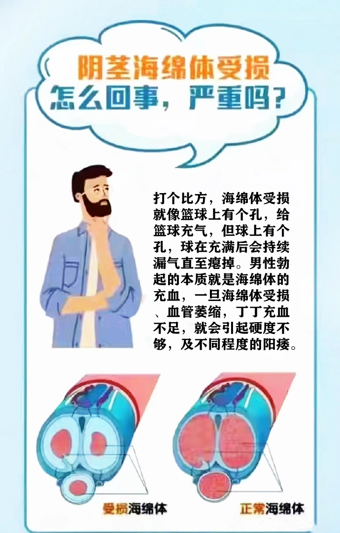 我们常说的"阴茎海绵体受损",是怎么回事?