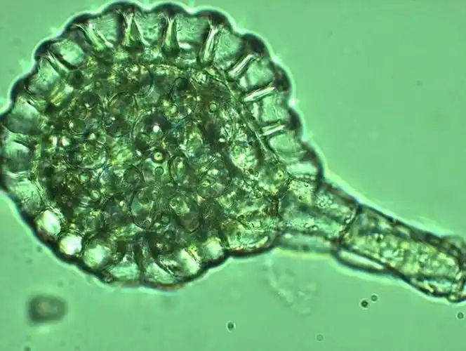 显微镜下的植物细胞