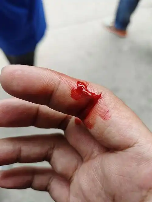 合约期内暴力解约,打伤员工,业主你是有多野