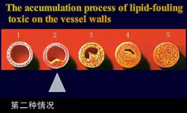 躯干四肢就会腰疼,腿疼,全身疼,毒垢在肌肉皮肤,就会长瘤,长疮,长癣斑