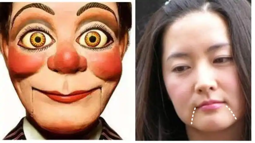 【原创】木偶纹用什么方法可以彻底治疗?