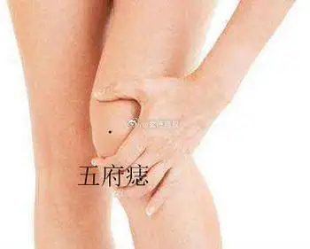 腿部的不同痣所代表的寓意不同,你知道吗?