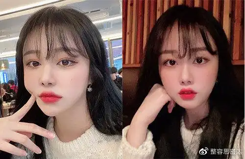 在韩国一般做全脸整容多少钱?20万够吗?10万可以整成什么样?