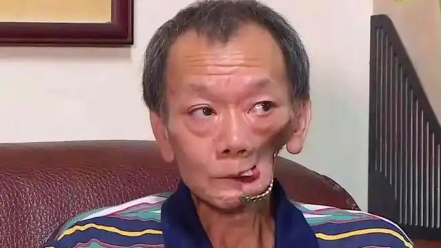 槟榔危害有多大?农村大叔嚼槟榔12年,如今连水都喝不下了