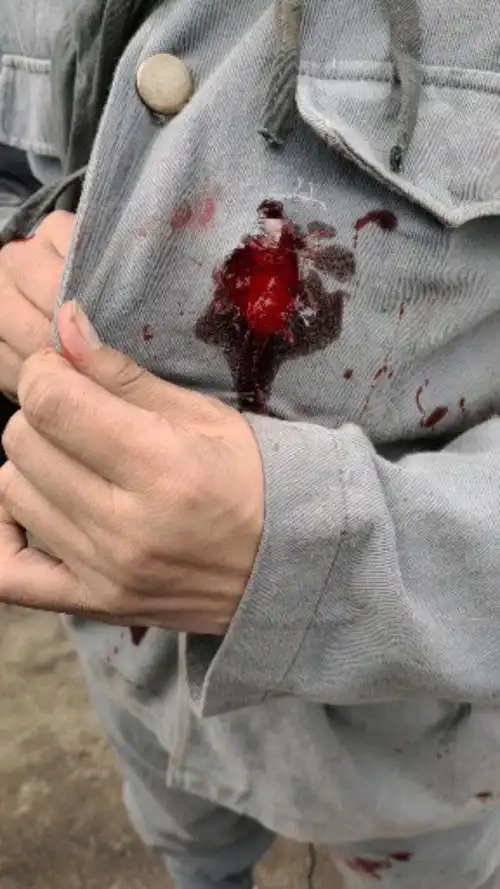 电视里的枪伤原来是这样的