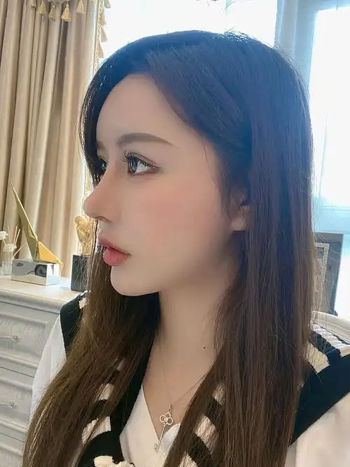 鼻子真人鼻子的图片真人鼻子照片真人隆鼻后恢复图片大全隆鼻后的效果