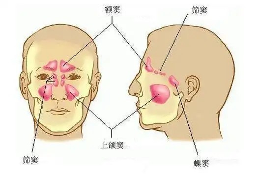眼睛胀痛找不到原因?可能患有鼻窦炎