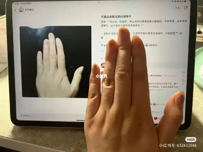 钢琴  #钢琴手  #手指歪斜