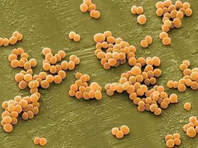 术前金黄色葡萄球菌筛查和去定植的成本效益分析(转帖)-热点团队-上海