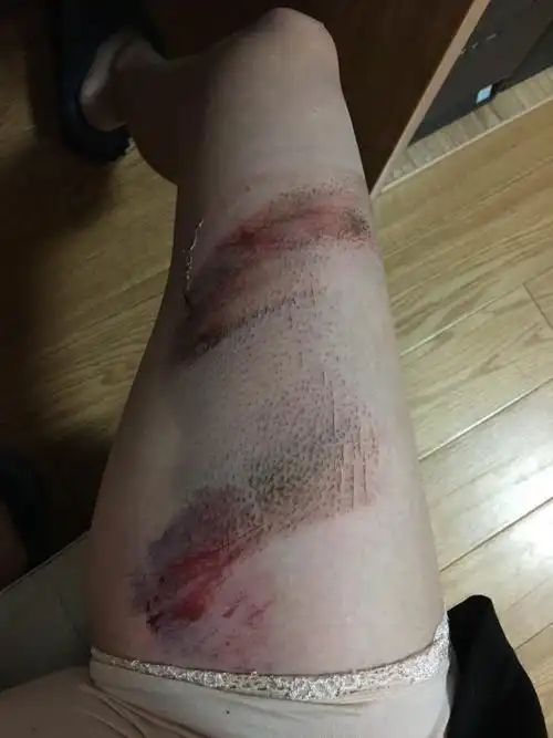 今天吃完晚饭从婆婆家回来,路上骑车不小心摔了一跤,车上还坐着大宝和