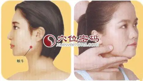【按摩疗法】用拇指指腹每天揉按颊车穴100~200次,可治疗腮腺炎,下颌