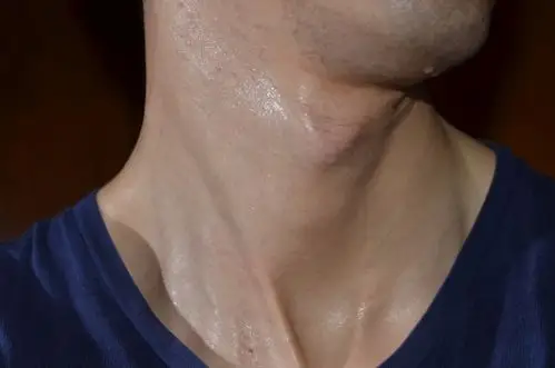 男子出汗的插图