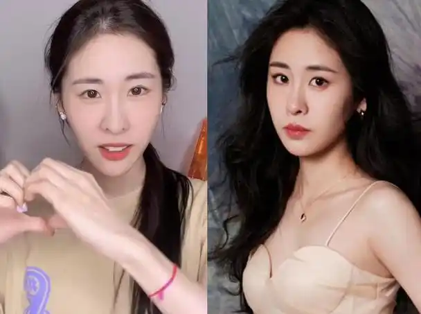 歌手张碧晨引争议素颜照曝光鼻孔大小不对称歪斜牙齿龅牙怪异