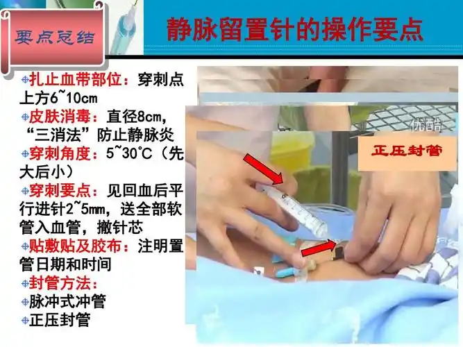 静脉留置针输液法ppt