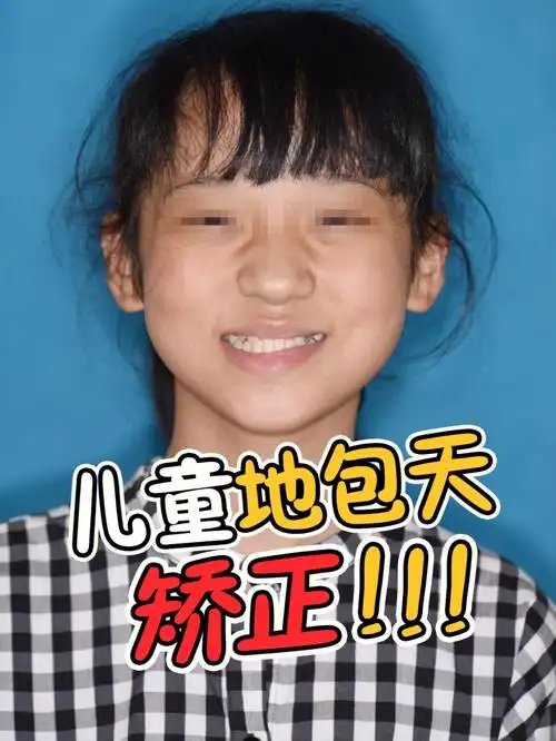 儿童牙齿矫正  #牙齿矫正