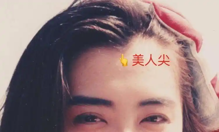 美人尖是什么意思