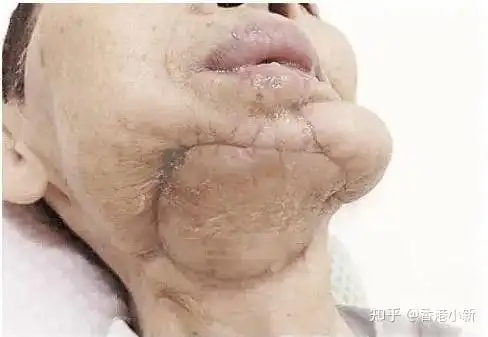 张艺兴嚼槟榔嚼出大麻烦,热剧《扫黑风暴》要禁播? - 知乎