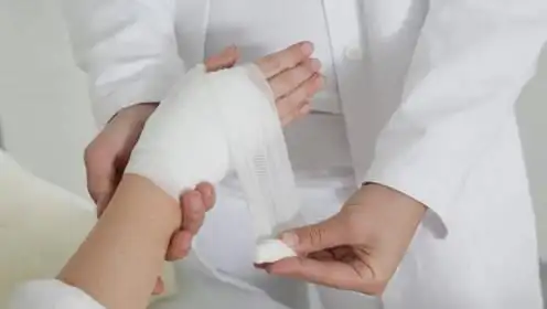 4.局部可涂烧伤膏用清洁的纱布覆盖.