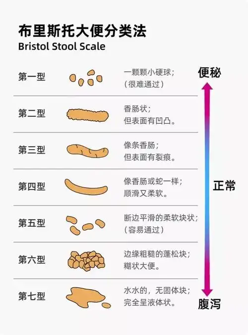 【暑夏科普季】浅谈儿童功能性便秘_影响_诊断_大便