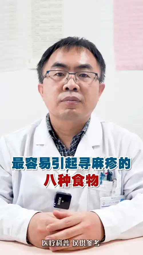 最容易引起荨麻疹的八种食物