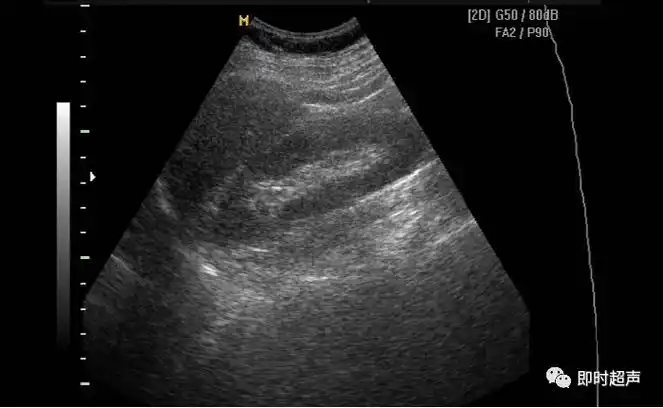 超声切面的标准测量