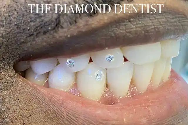 敢不敢来一款"壕无人性"的镶钻牙饰_钻石_拉杰帕尔_牙齿