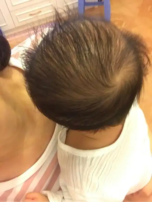 现在一边高一边低,尤其男孩子短发不好看