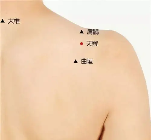 其实肩周炎可以用艾灸的,一个方法教你做艾艾贴艾灸