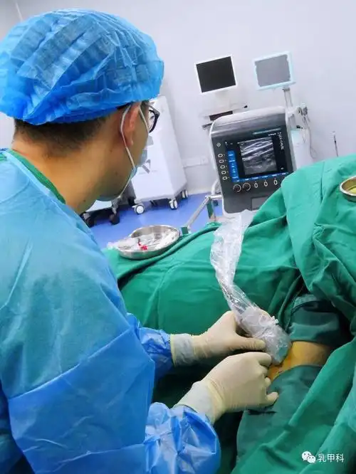 手臂港--乳腺癌化疗的新选择_乳腺癌_乳腺癌治疗方式 - 好大夫在线