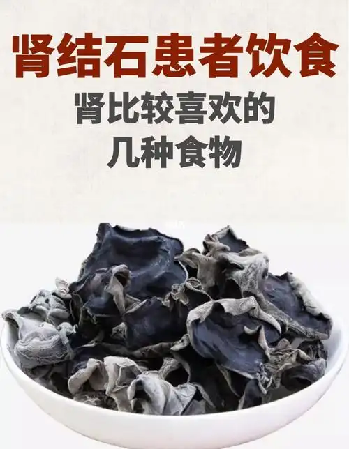 常吃这五种食物肾结石最快一个月排石60