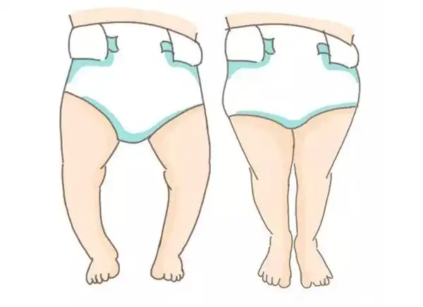 将不利于生长发育,包括影响身高,导致长短腿等