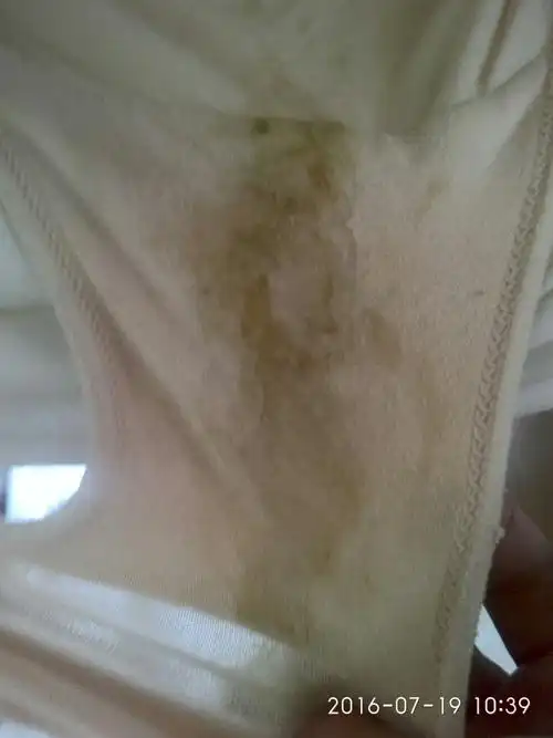 38周了白带又是白色的 内裤上黄黄的. 粘粘的