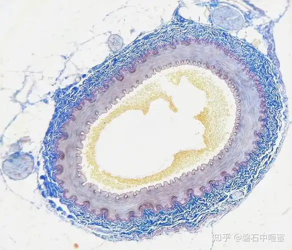 人动脉的横截面另请参阅:动脉树动脉的解剖结构可被分离成大体解剖,在