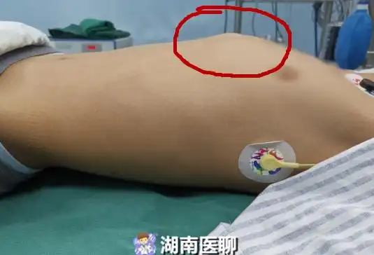 鸡胸是什么(鸡胸是什么样子的)_兴正网