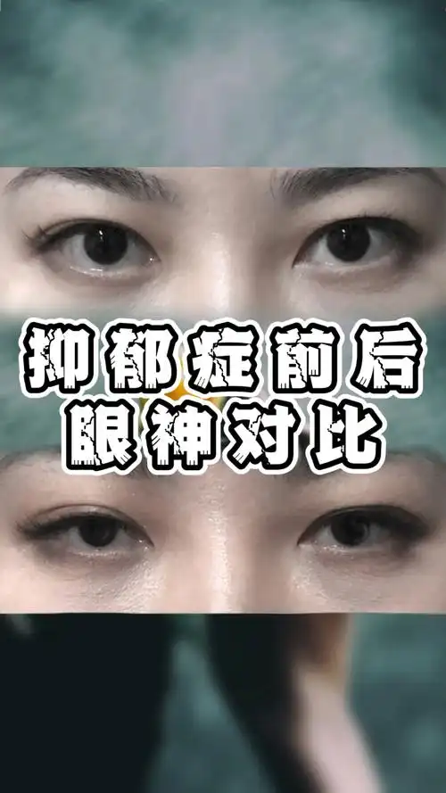 抑郁症前后眼神对比让人震惊大家可以去观察观察身边的人