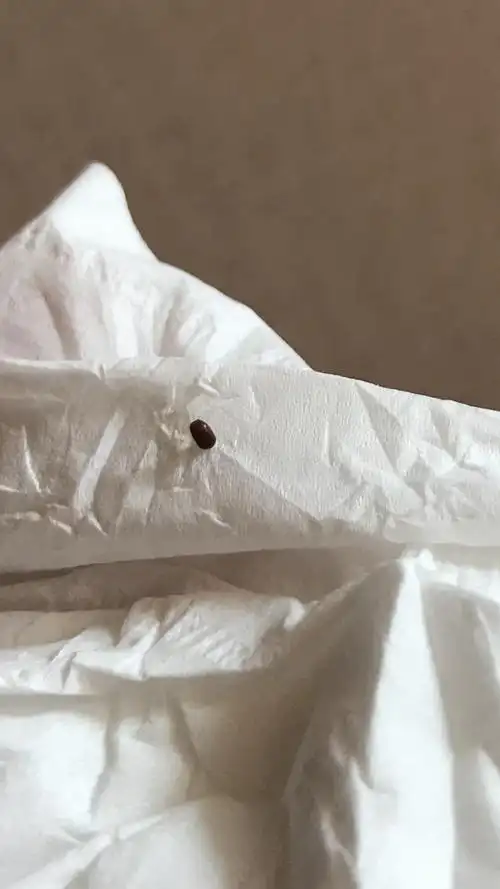 这是床上吸血虫 叫什么虫 抓它的时候动也不多 皮肤咬了出疙瘩痒 真是