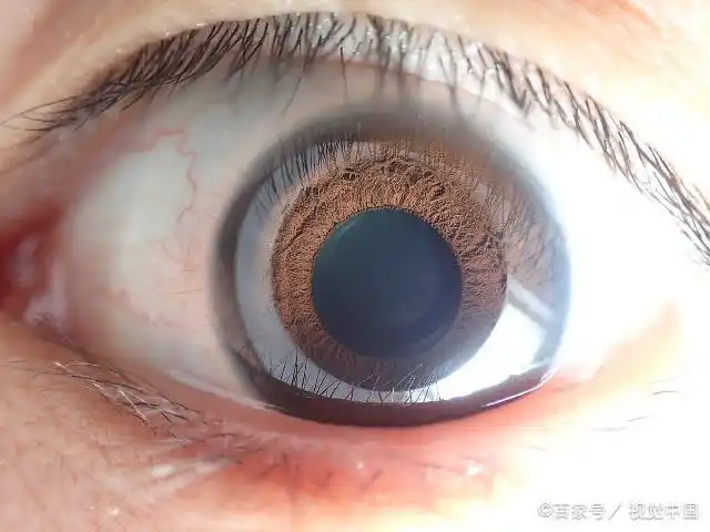 整体看人眼虹膜