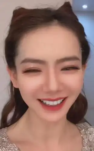 戚薇的"钻石牙"太闪亮了!整齐又洁白,笑起来心都醉了!
